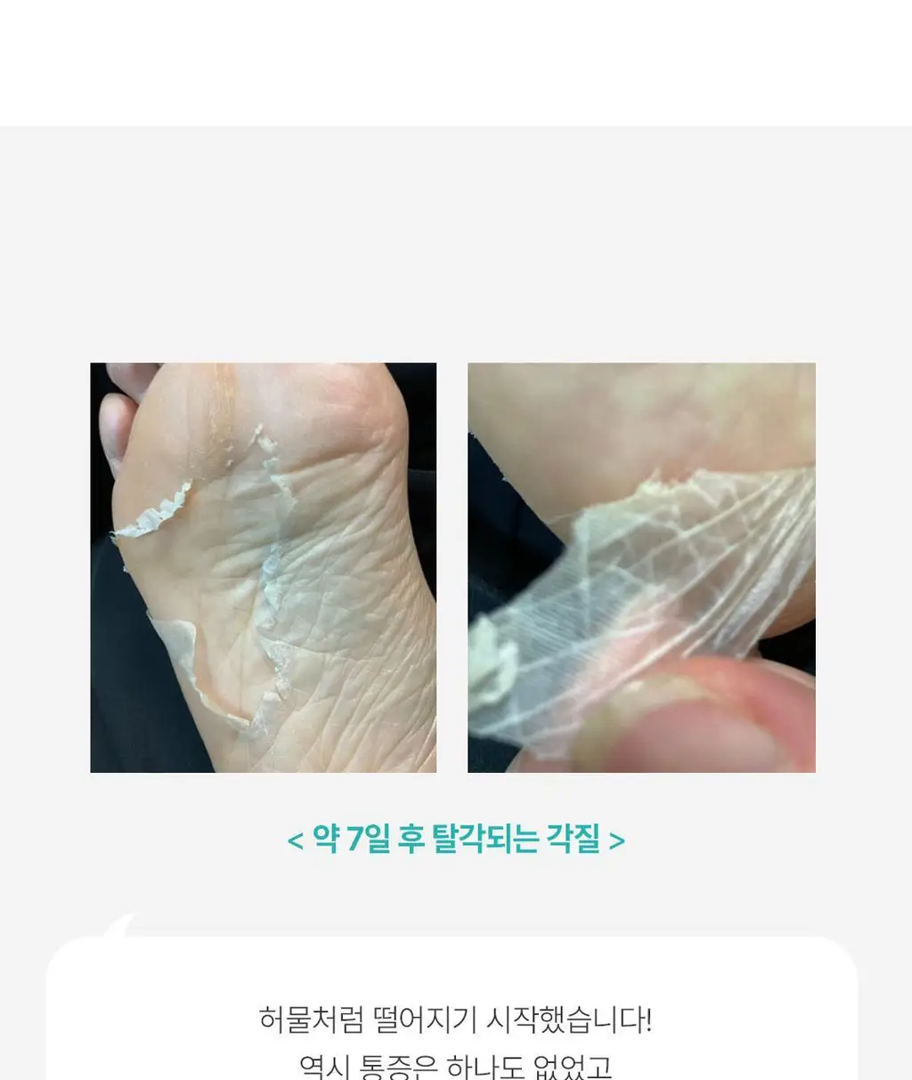 [발허물팩] 아리얼 스무스 앤 퓨어 풋 필링 마스크 2입 7종 택1 상세페이지 26